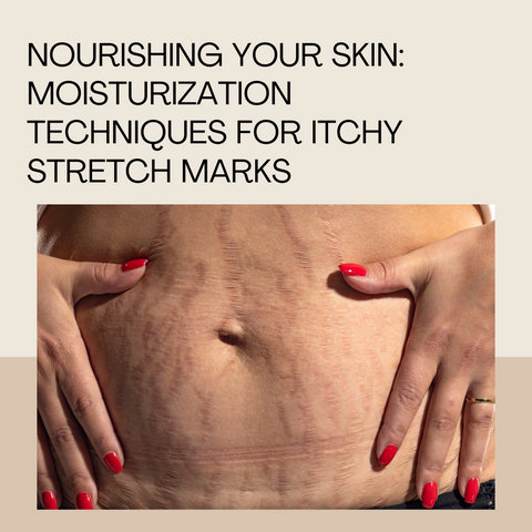 Nourishing Your Skin: Moisturization Techniques for Itchy Stretch Marks