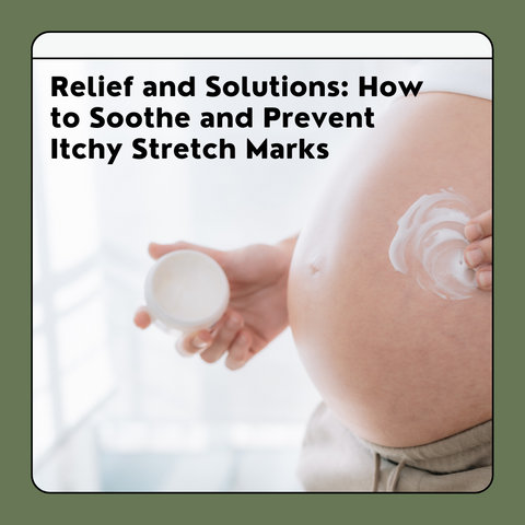 Relief and Solutions: How to Soothe and Prevent Itchy Stretch Marks