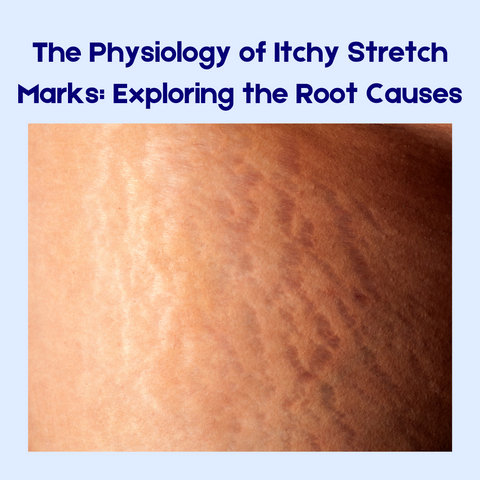 The Physiology of Itchy Stretch Marks: Exploring the Root Causes