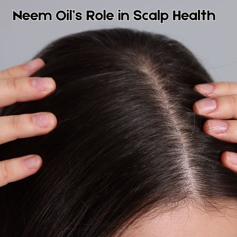 Neem Oil’s Role in Scalp Health