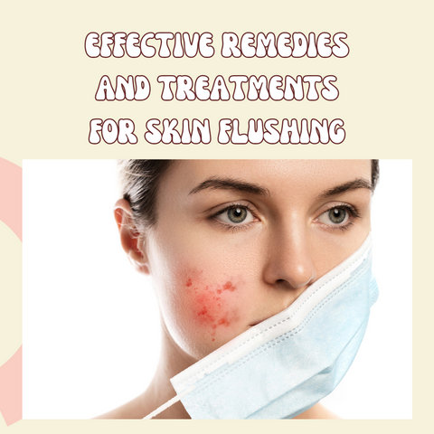 Effective Remedies and Treatments for Skin Flushing
