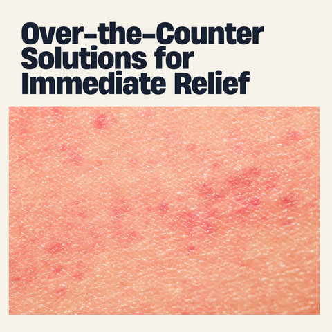 Over-the-Counter Solutions for Immediate Relief