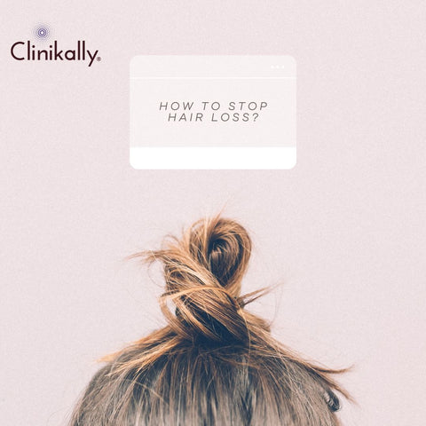 hair loss