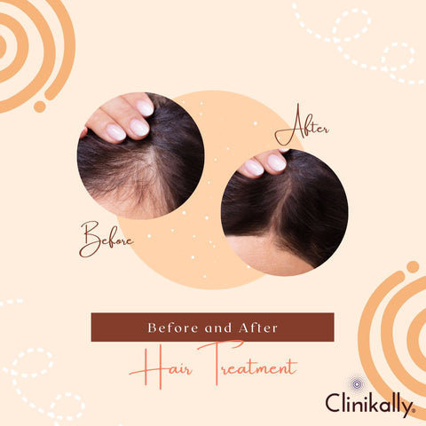 Uncovering the Connection Between Sweating and Hair Loss