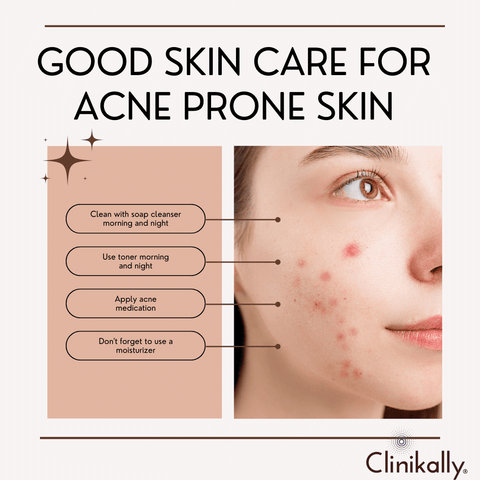 Acne prone skin