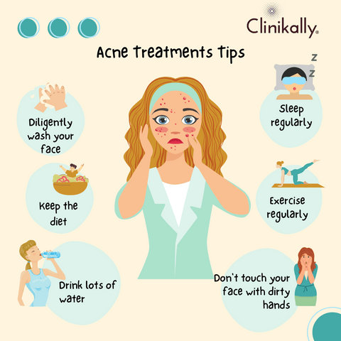 Acne Treatments