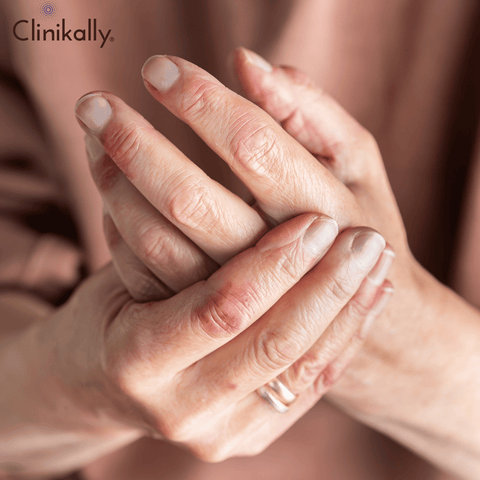 rashes on hands