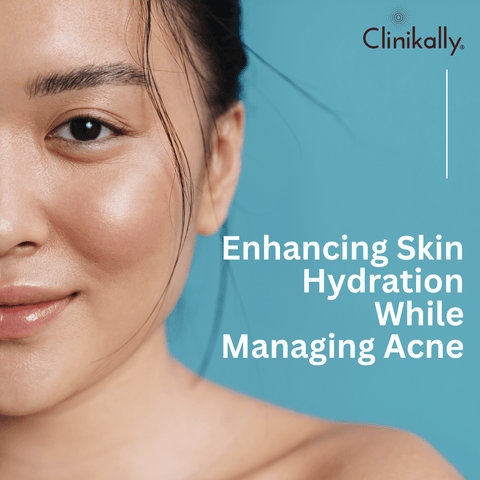 Enhancing Skin Hydration While Managing Acne