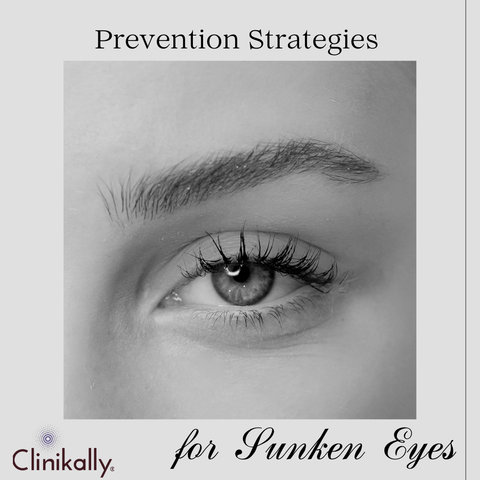 Preventing Sunken Eyes