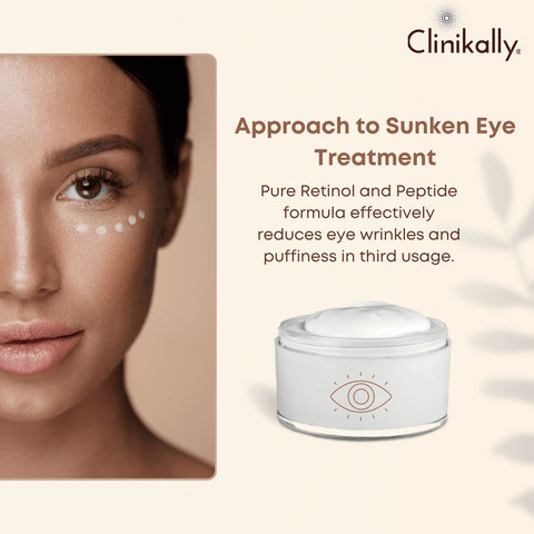 Final Thoughts: Addressing Sunken Eyes Naturally