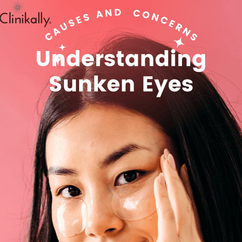 Understanding Sunken Eyes