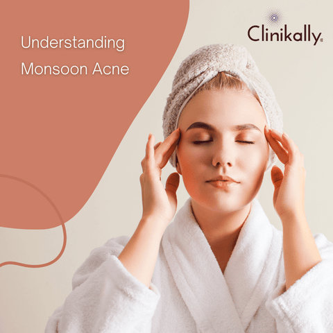 Understanding Monsoon Acne