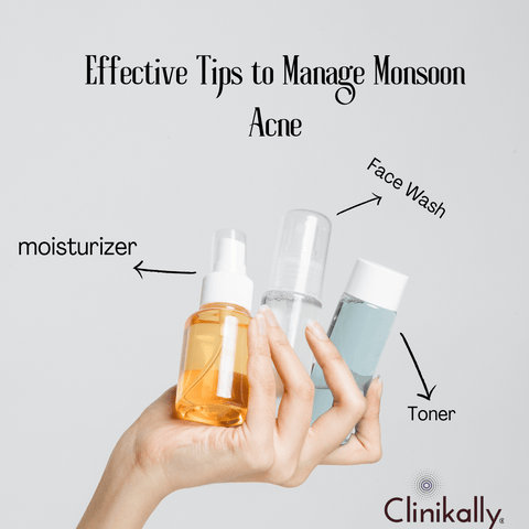 Manage Monsoon Acne