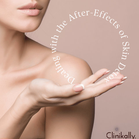 Dealing with the After-Effects