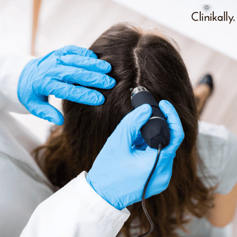 Identifying Excessive Hair Shedding