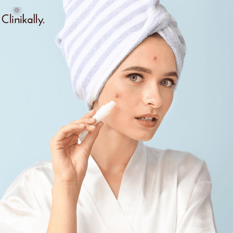 Addressing Hyperpigmentation with Niacinamide