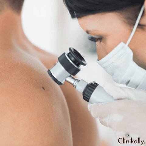 What Is a Mole?