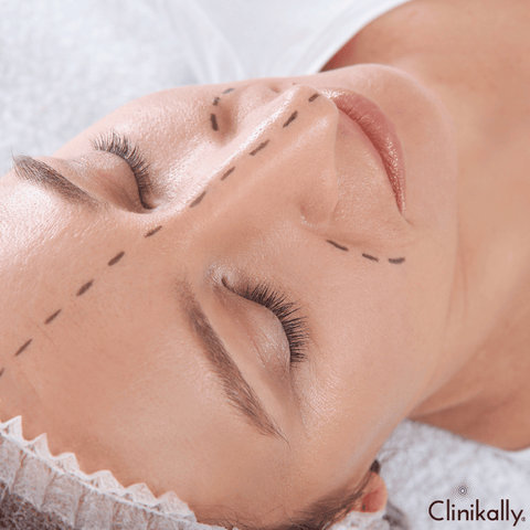 Enhancing and Caring for Your Beauty Marks