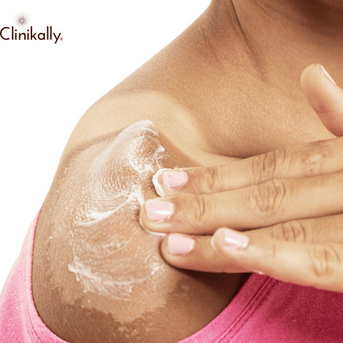 The Science Behind Sun Spots