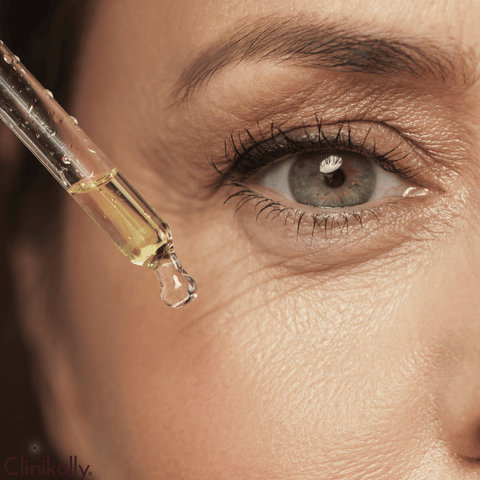 Understanding Undereye Bumps and Wrinkles