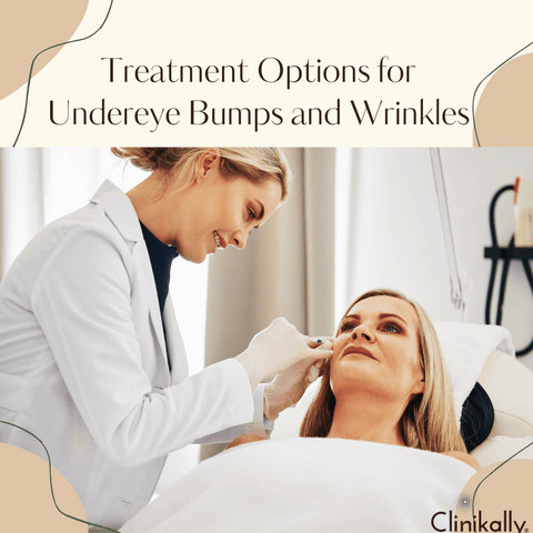 Treatment Options for Undereye Bumps and Wrinkles