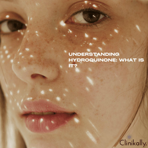 Understanding Hydroquinone: What Is It?