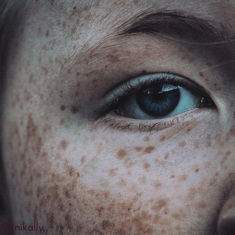 Making an Informed Decision about Hydroquinone Use