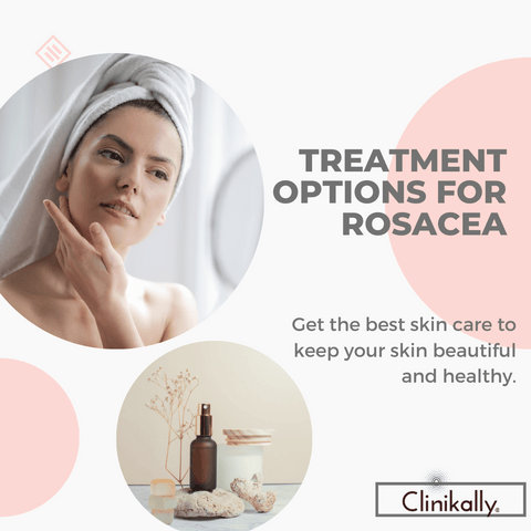 Treatment Options for Rosacea