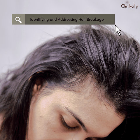 Identifying and Addressing Hair Breakage