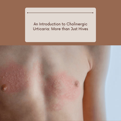 An Introduction to Cholinergic Urticaria: More than Just Hives