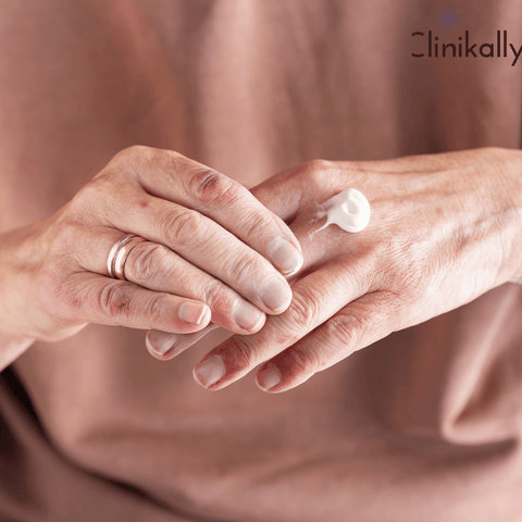 topical treatments