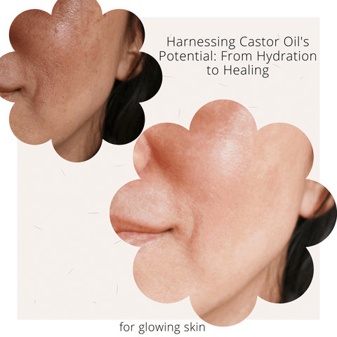 Harnessing Castor Oil's Potential: From Hydration to Healing