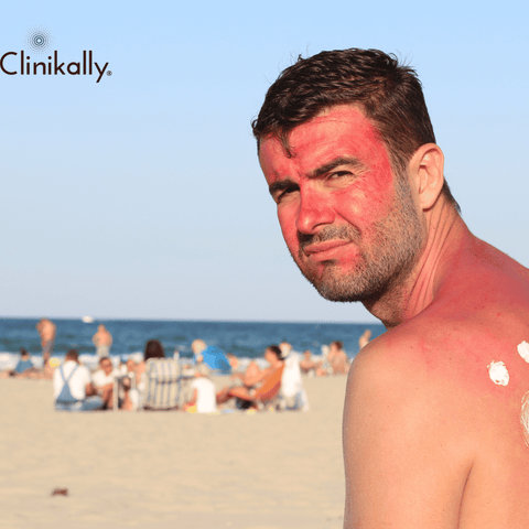 Sun Damage of men