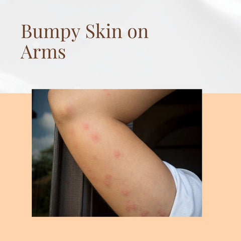 Bumpy Skin on Arms