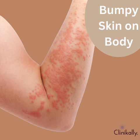 Bumpy Skin on Body