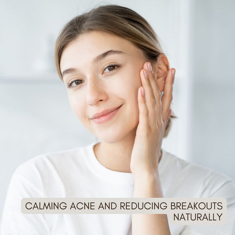 Calming Acne and Reducing Breakouts Naturally