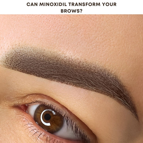 Can Minoxidil Transform Your Brows?