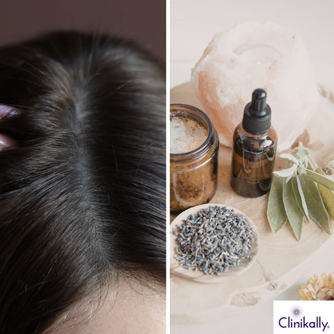 Healthy scalp with natural hair remedies