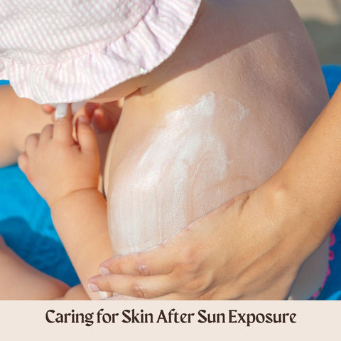 Caring for Skin After Sun Exposure