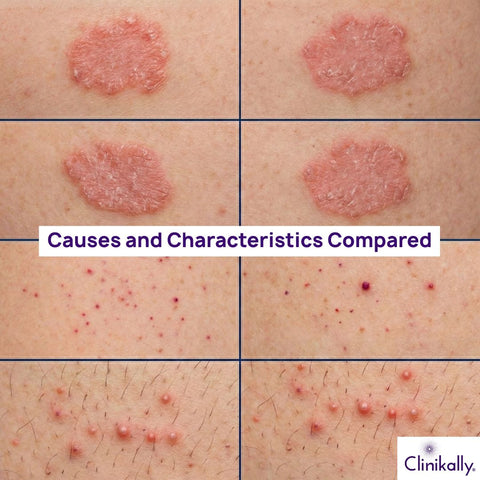 Causes and Characteristics Compared