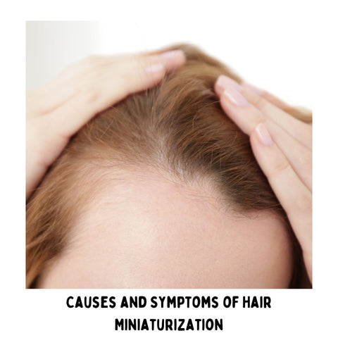 Causes and Symptoms of Hair Miniaturization