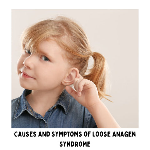 Causes and Symptoms of Loose Anagen Syndrome