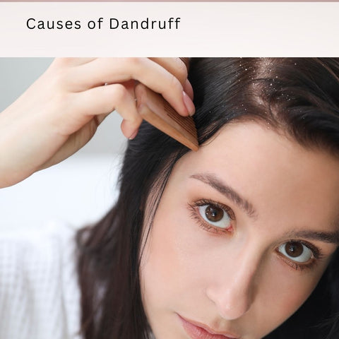 Causes of Dandruff