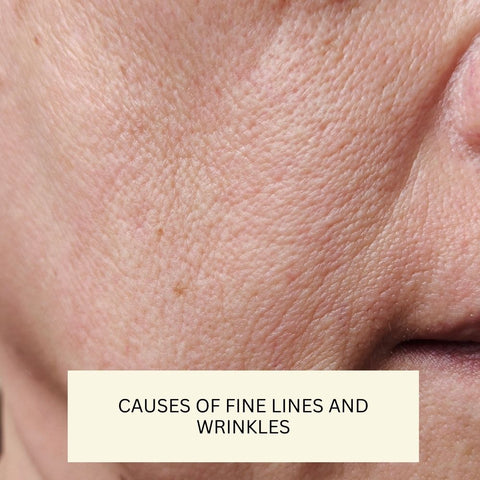 Causes of Fine Lines and Wrinkles
