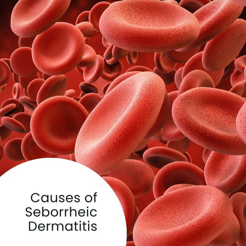 Causes of Seborrheic Dermatitis