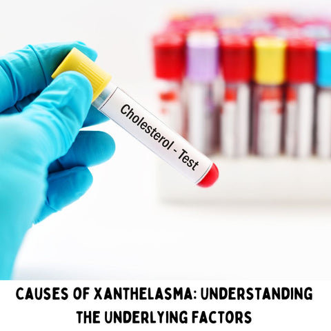Causes of Xanthelasma: Understanding the Underlying Factors