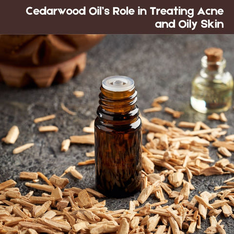 Cedarwood Oil’s Role in Treating Acne and Oily Skin