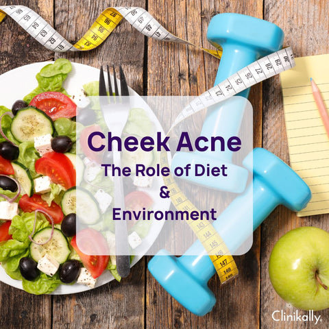 Cheek Acne: The Role of Diet & Environment