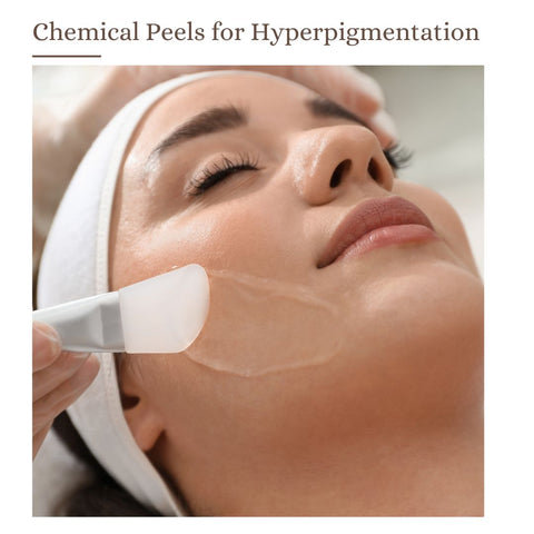 Chemical Peels for Hyperpigmentation