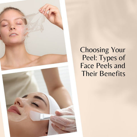 Choosing Your Peel: Types of Face Peels and Their Benefits